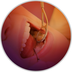 Dental & Implantology Instruments  border=